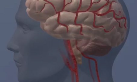 Brain activity may be predictor of stress-related cardiovascular risk