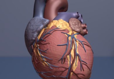 Risk of heart disease in urban ‘food deserts’ is associated with individual’s income, rather than access to healthy food
