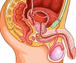What Does Prostate Cancer Do to You?