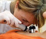 How to Do a Skin Cancer Body Check