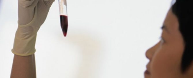 Could a Blood Test Spot Early Stage Colon Cancer?