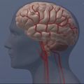 Survivors of childhood heart defects may have higher risk of premature dementia