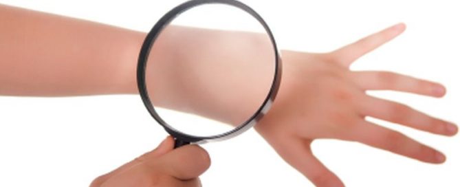 Defense Against Skin Cancer May Live on Your Skin