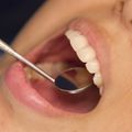 Middle-aged tooth loss linked to increased coronary heart disease risk