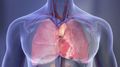 Heart disease, stroke less widespread among foreign-born vs. U.S.-born adults