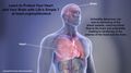 Limited health literacy is a major barrier to heart disease prevention and treatment