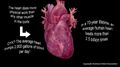 Long-term survival worse for black survivors of in-hospital cardiac arrest; Commonalities found in hospitals with best overall in-hospital cardiac arrest survival rates
