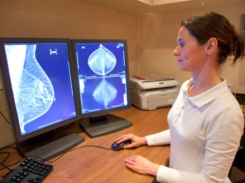 Breast Cancer Drug Promising in Phase 3 Trial