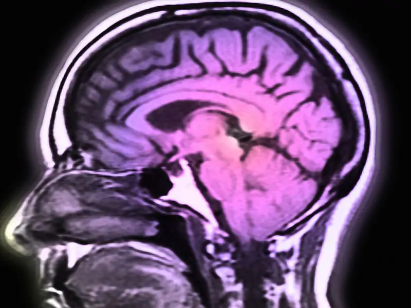 Could the Zika Virus Fight the Brain Cancer That Killed John McCain?