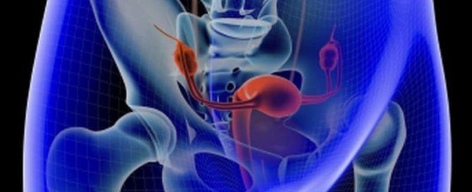 What Every Woman Needs to Know About Ovarian Cancer