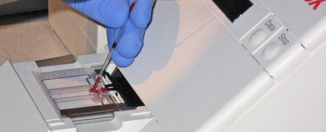 Lead, mercury exposure raises cholesterol levels
