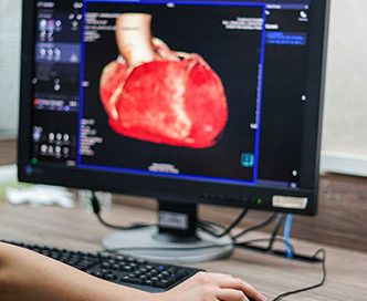 Study Supports Enhanced Screening Prior to Invasive Heart Disease Imaging
