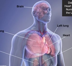 High-risk sexually transmitted HPV virus associated with increased cardiovascular disease risk
