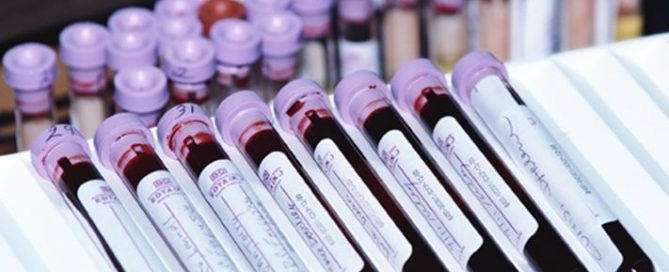 Could Invasive Lung Cancer Biopsies Be Replaced by Blood Tests?