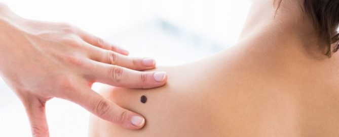 High-Fiber Diet May Help Gut ‘Microbiome’ Battle Melanoma
