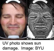 Pics of Sun’s Damage to Face Boost Sunscreen Use
