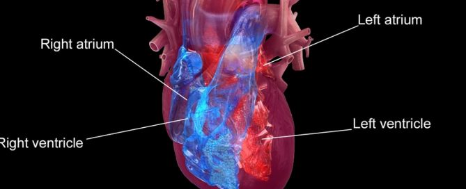 Preventive drug therapy may increase right-sided heart failure risk in patients who receive heart devices