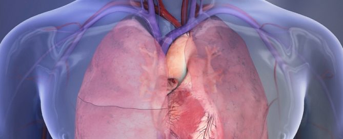 Heart failure deaths are highest in the poorest U.S. counties