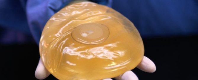 FDA May Put Strong Warning on Breast Implants