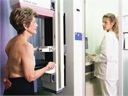 Switching Mammograms to Once Every 2 Years Could Come With Risks