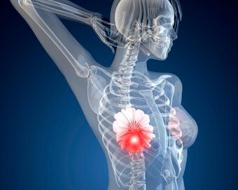 Facts You Should Know About Breast Cancer