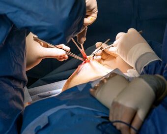 Breast Cancer Treatment Options: Plan and Guidelines