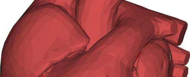 Fast action and the right resources are key to treating fulminant myocarditis