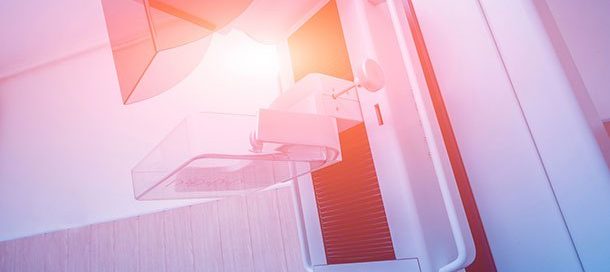 AI Better at Reading Mammograms Than Radiologists