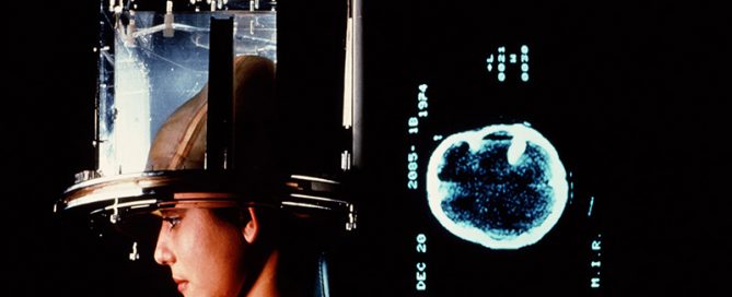 More Aggressive Surgery Can Extend Survival From Brain Cancer: Study