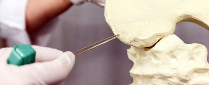 What Conditions Do You Need a Bone Marrow Transplant for?