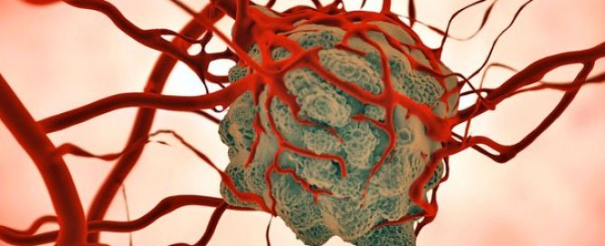 WHO Aims to Save 7 Million in Developing Countries From Cancer