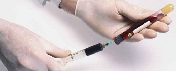 Blood Test Could Spot 50 Different Cancers