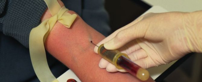 New Blood Test May Improve Liver Cancer Screening