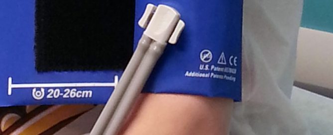 Obstructive sleep apnea is common in kids and may impact blood pressure, heart health