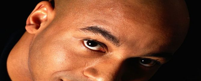 Black Melanoma Patients Face Treatment Delays: Study