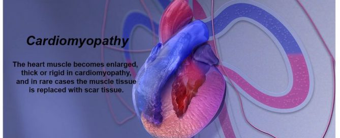 Genetic testing for heart diseases may help patients and families identify risks