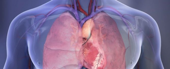 Spouses of ICU patients may be at increased risk for cardiac events or hospitalization