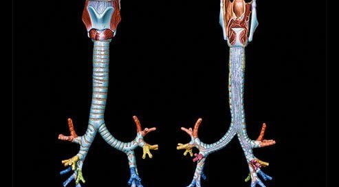 What Is Tracheo-Bronchial Sleeve Resection?