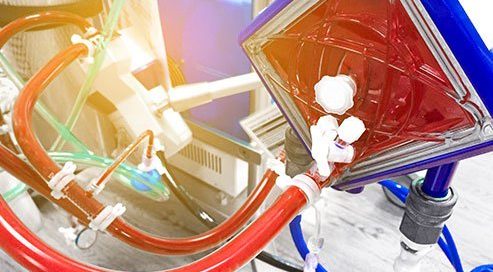 What Conditions Are Extracorporeal Photopheresis Used For?