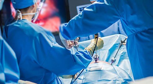 Why Is Video-Assisted Thoracoscopic Surgery (VATS) Done?