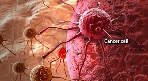 How Long a Person Can Live With Multiple Myeloma?