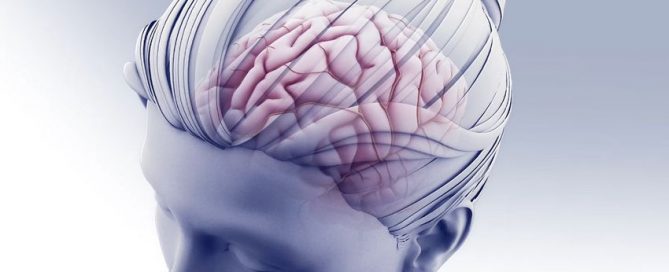 Steps outlined to reduce the risk of stroke during, after heart surgery