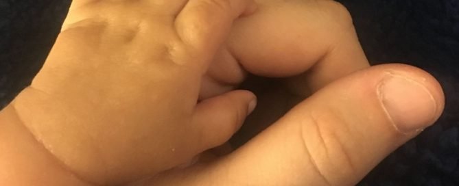 Home monitoring program improves survival between surgeries for babies with certain heart defects