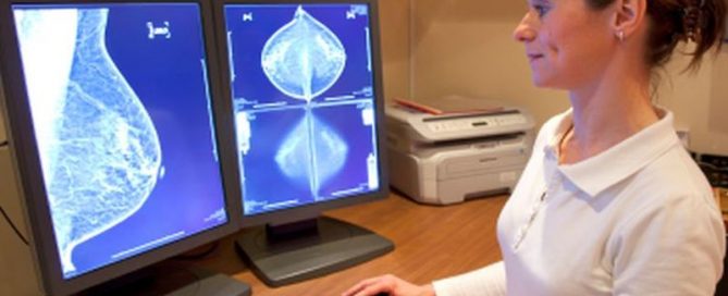 Is an Early Form of Breast Cancer More Dangerous Than Thought?
