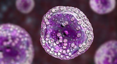 What Is the Survival Rate for Follicular Lymphoma?
