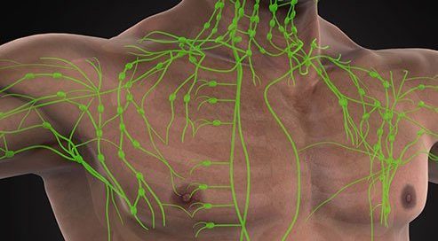 What Happens if Melanoma Gets Into Lymph Nodes?