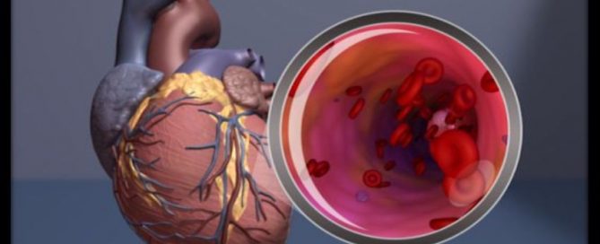 Gender-affirming hormone therapy may not increase CVD risk for transgender adolescents