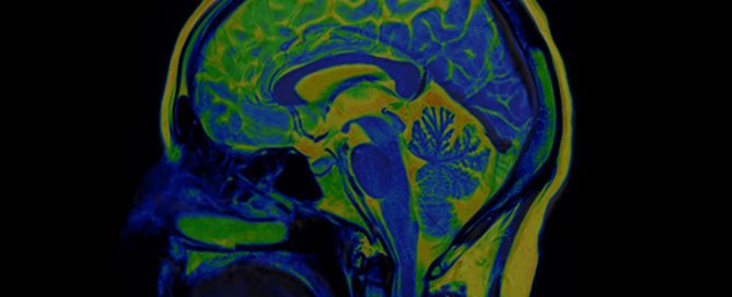 Biomarkers identified in collegiate athletes that could help predict time needed to recover from concussion