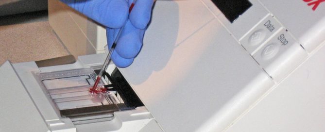 Eating walnuts daily lowered bad cholesterol and may reduce cardiovascular disease risk