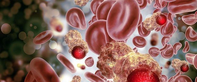 Can Leiomyosarcoma Be Hereditary?